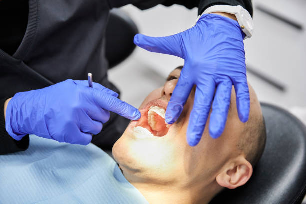 Best Emergency Dental Filling Replacement  in Sudan, TX