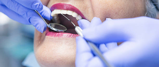 Best Chipped Tooth Repair Near Me  in Sudan, TX